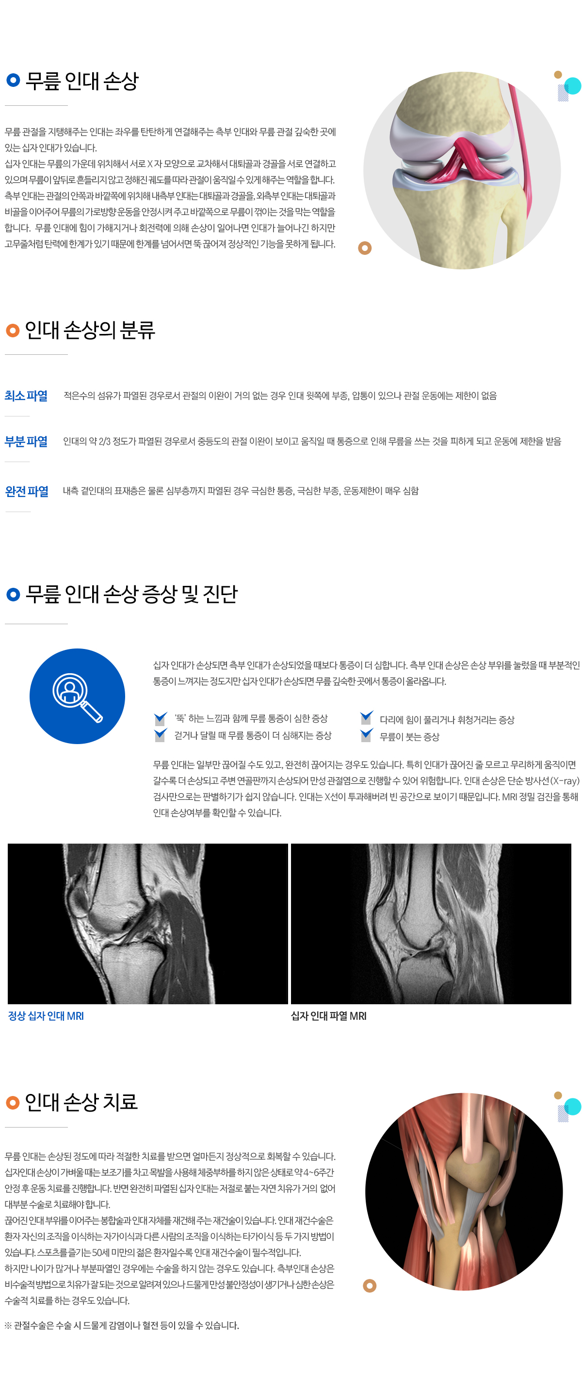무릎 인대 손상