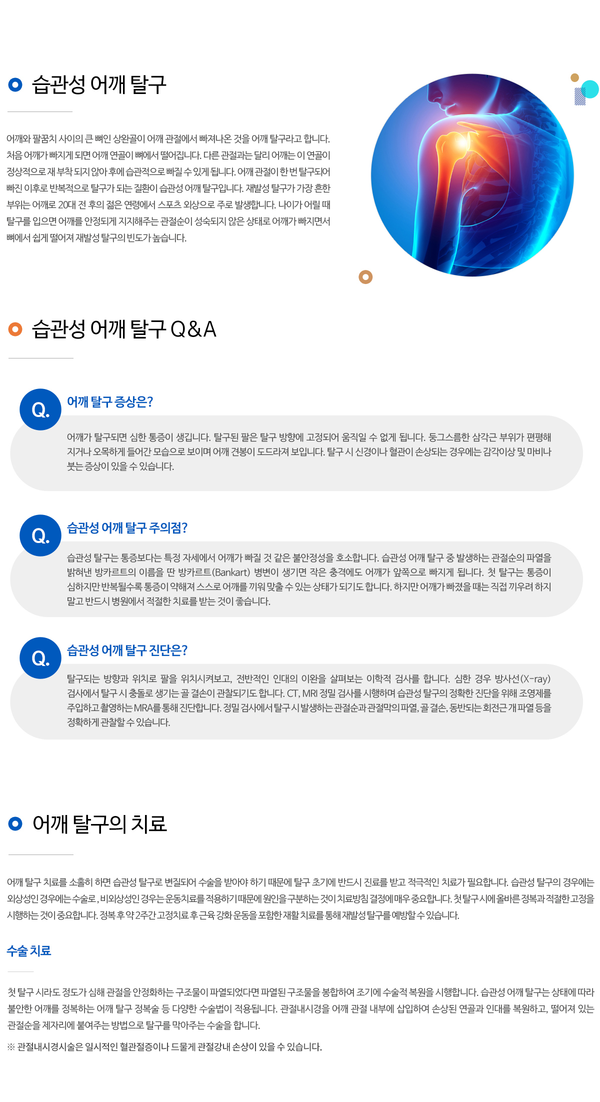 습관성 어깨 탈구