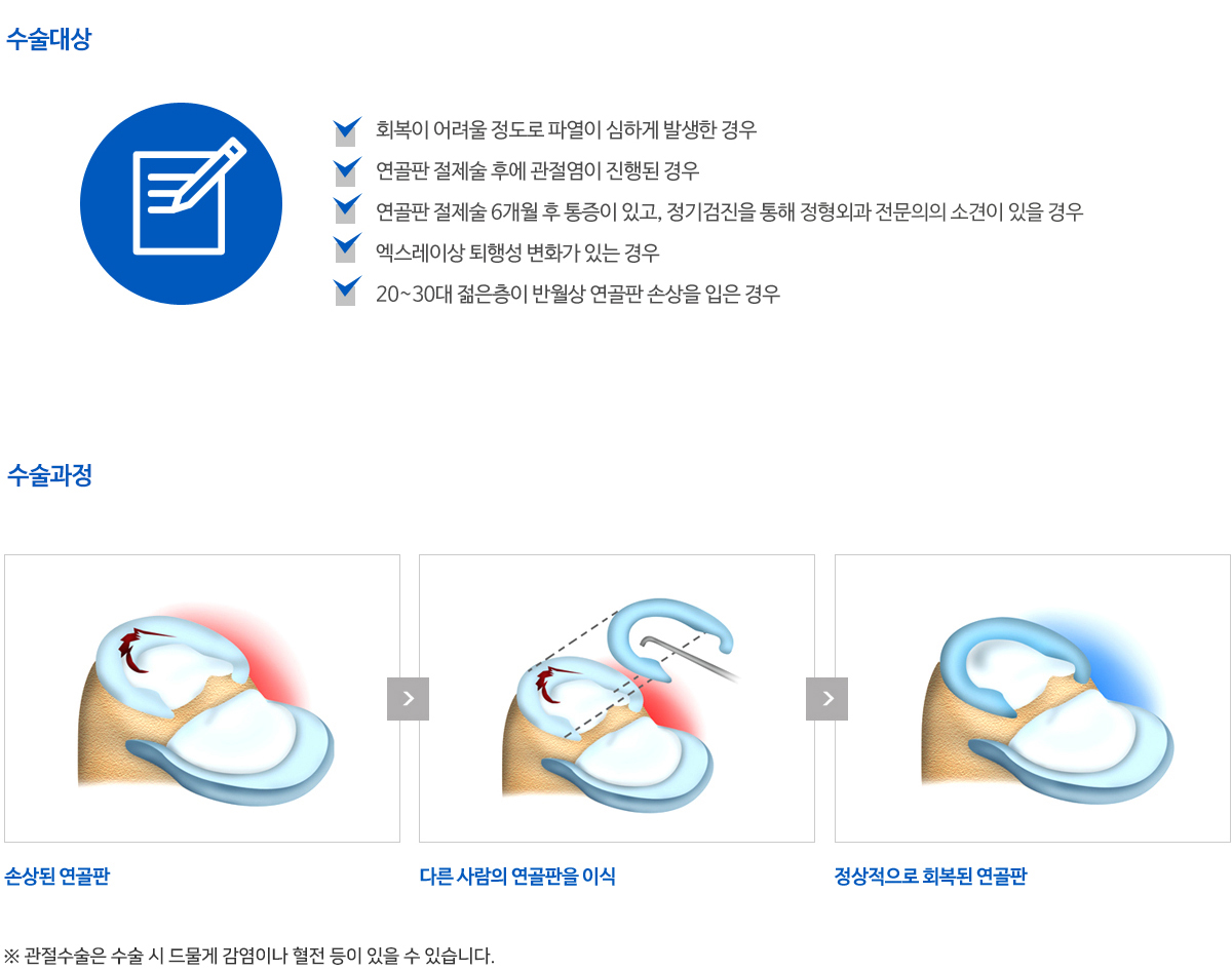 연골재생(줄기세포)