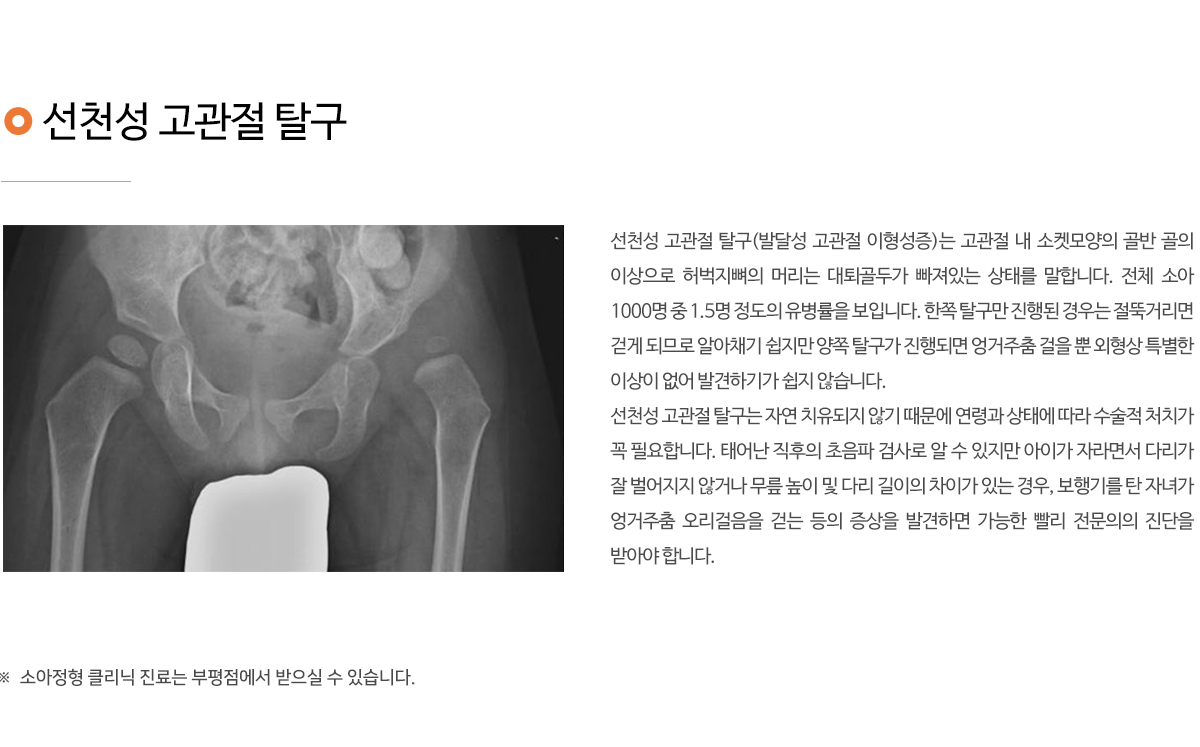 소아정형외과