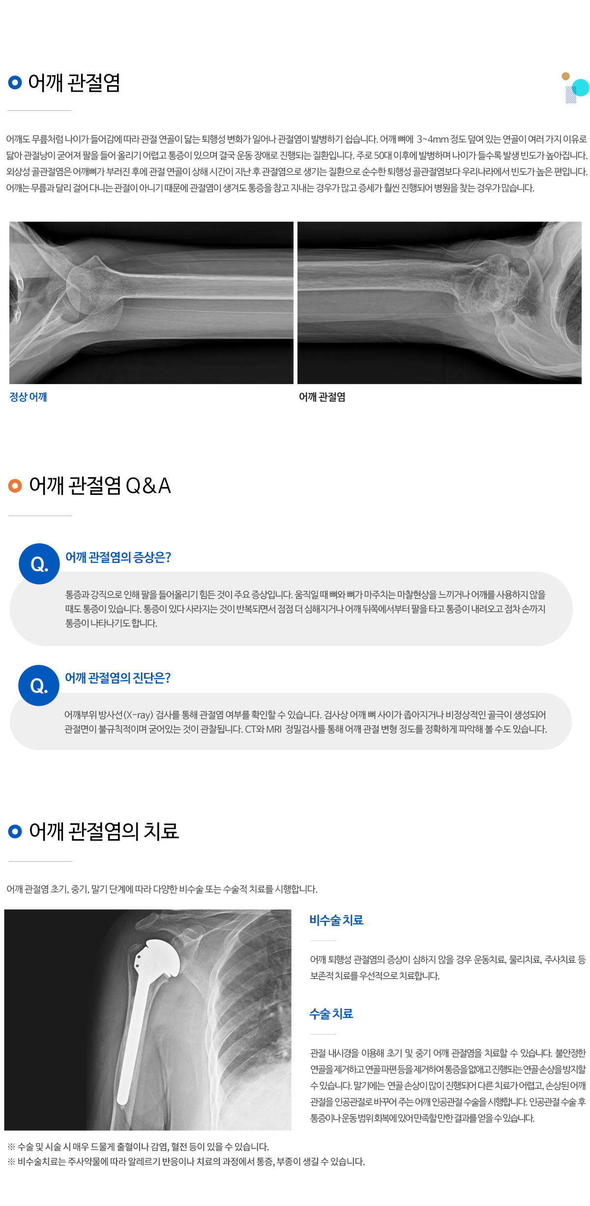 어깨관절염