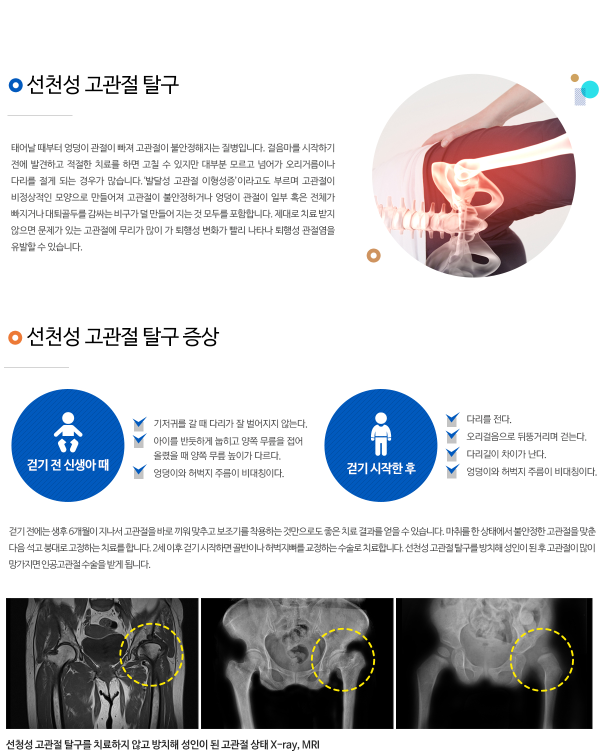 기타질환(고관절 이형성증, 점액낭염 )