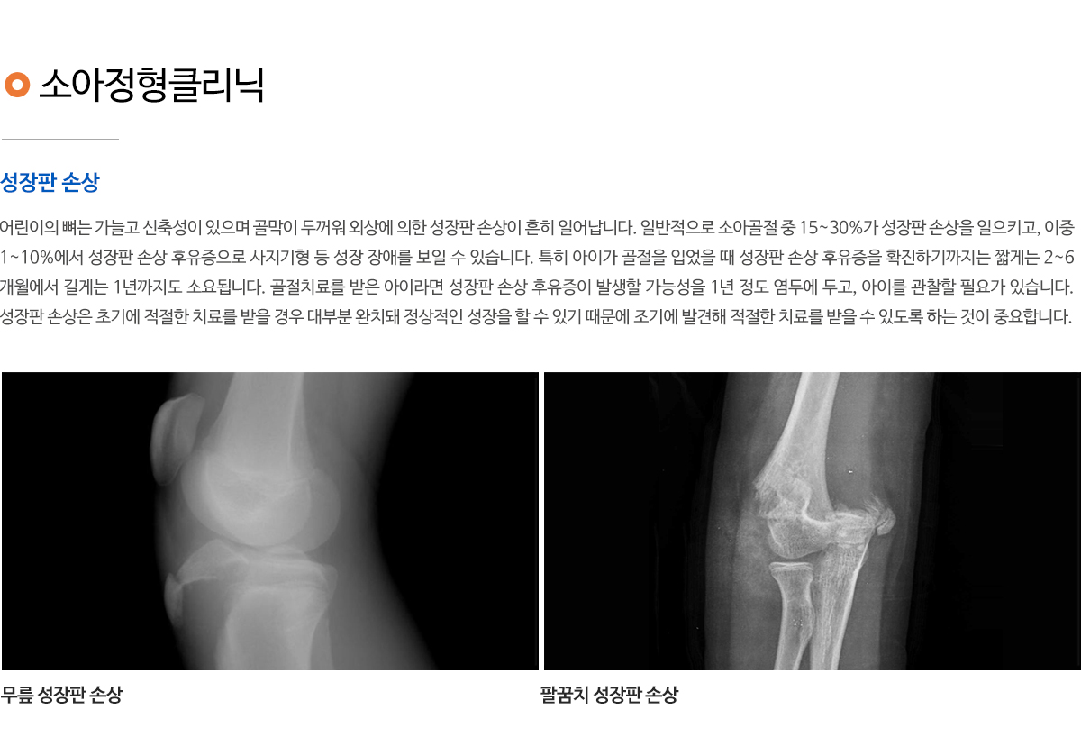 골다공증