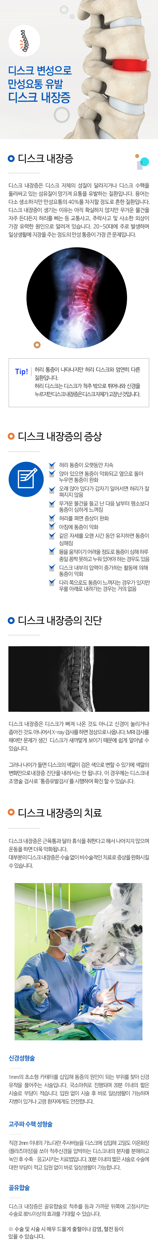 디스크 내장증