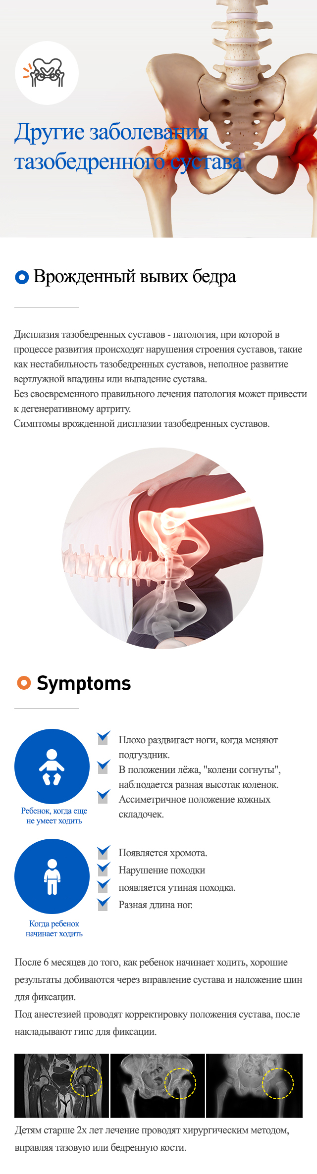 Other diseases