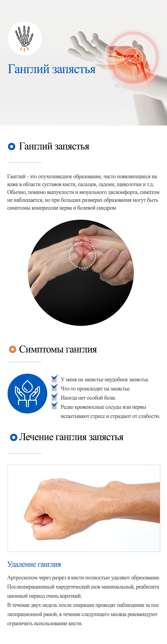 Tenosynovitis